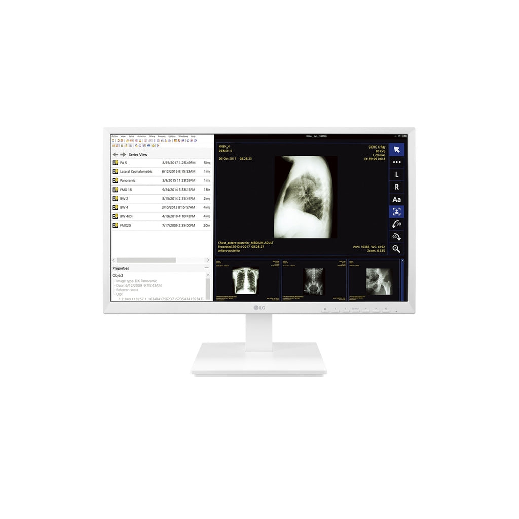 LG Thin Client 24CK560N-3A 24" 4GB 32GB AMD GX-212JJ X2 1.2GHz NO OS, Black (New Open Box)