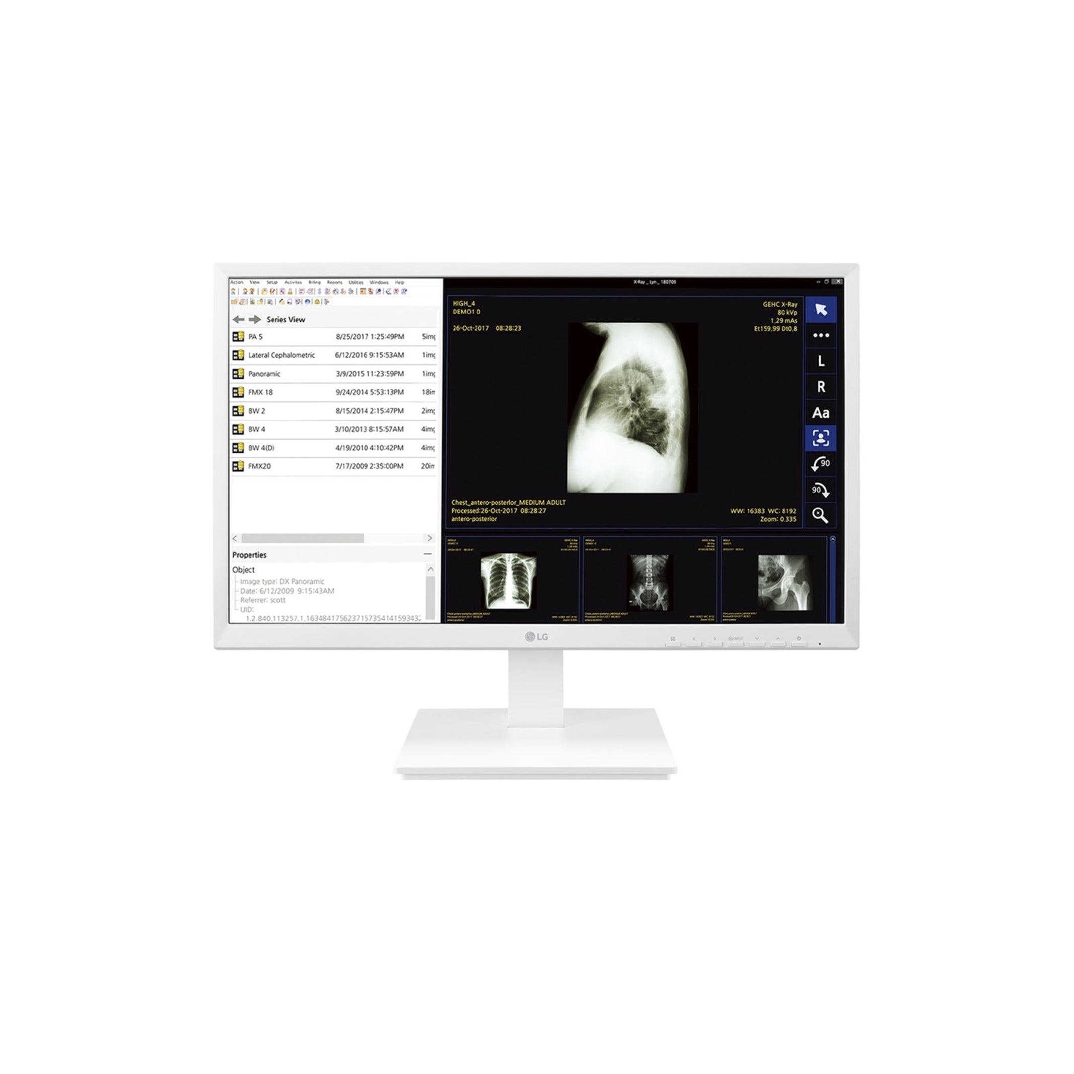 LG Thin Client 24CK560N-3A 24" 4GB 32GB AMD GX-212JJ X2 1.2GHz NO OS, Black (New Open Box)